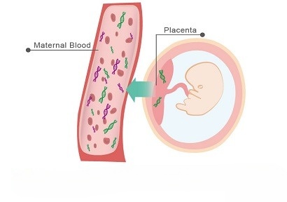  NIPT – Non-Invasive Prenatal Screening Test