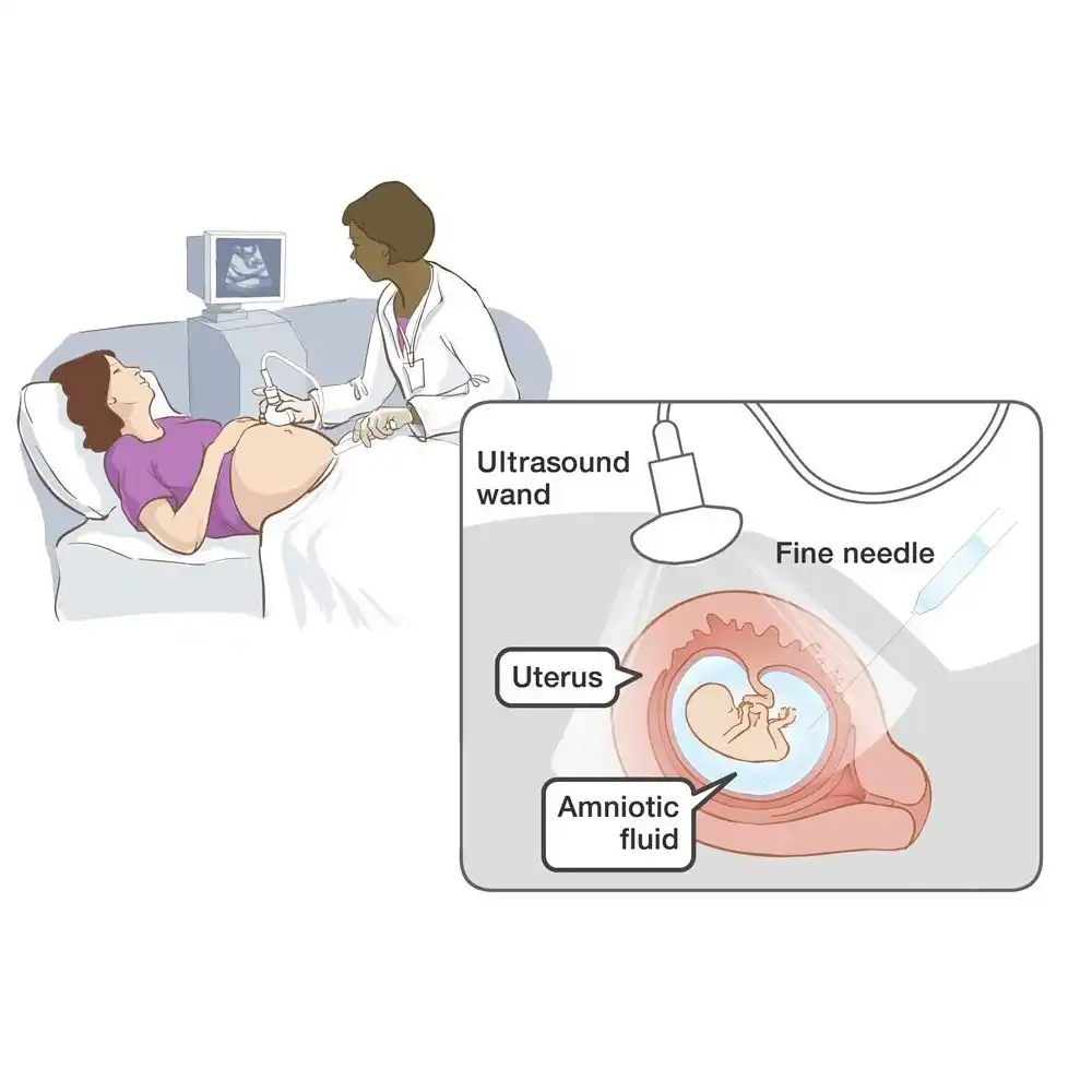 Invasive Tests